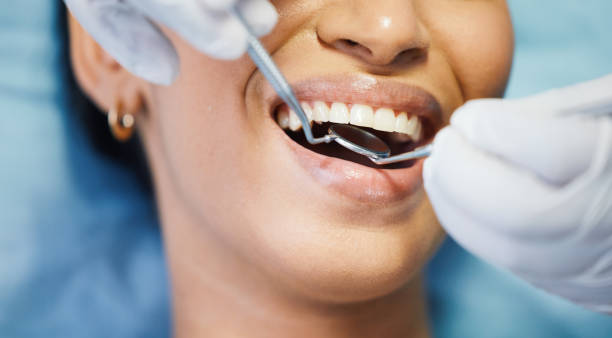 Best Same-Day Emergency Dentist in Ravenel, SC